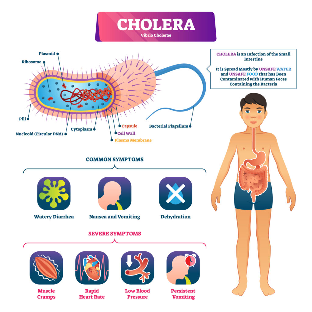 Cholera vector illustration. Labeled infection structure and symptom scheme