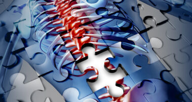Human back disease medical concept with a jigsaw puzzle texture and a piece missing as a broken skeleton anatomy and a symbol of the spine and joint pain caused by inflamation.